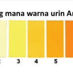 7 warna urin yang bisa mengambarkan kesehatan tubuh