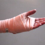 Makanan Mempercepat Penyembuhan Luka